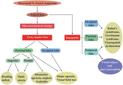 Neural Mechanisms of Visual Dysfunction in Posterior Cortical Atrophy